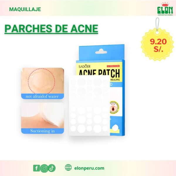 Parches de acne